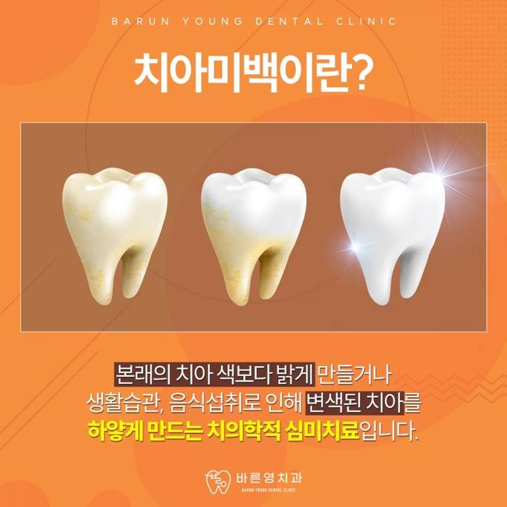 옥수역치과, 당당하게 웃게 해주는 치아미백 치료 원한다면 사진 5