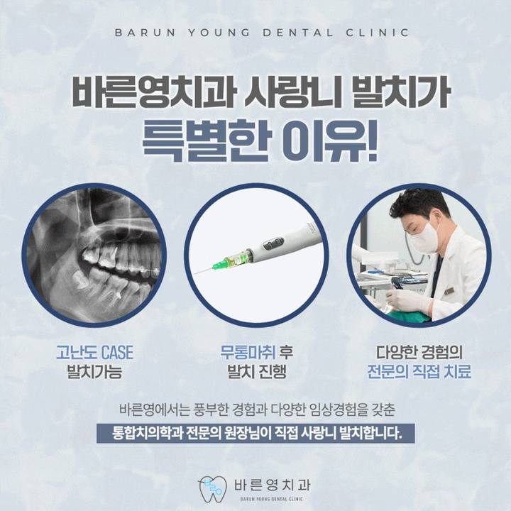 신당동치과 사랑니 발치가 필요한 순간은 사진 9