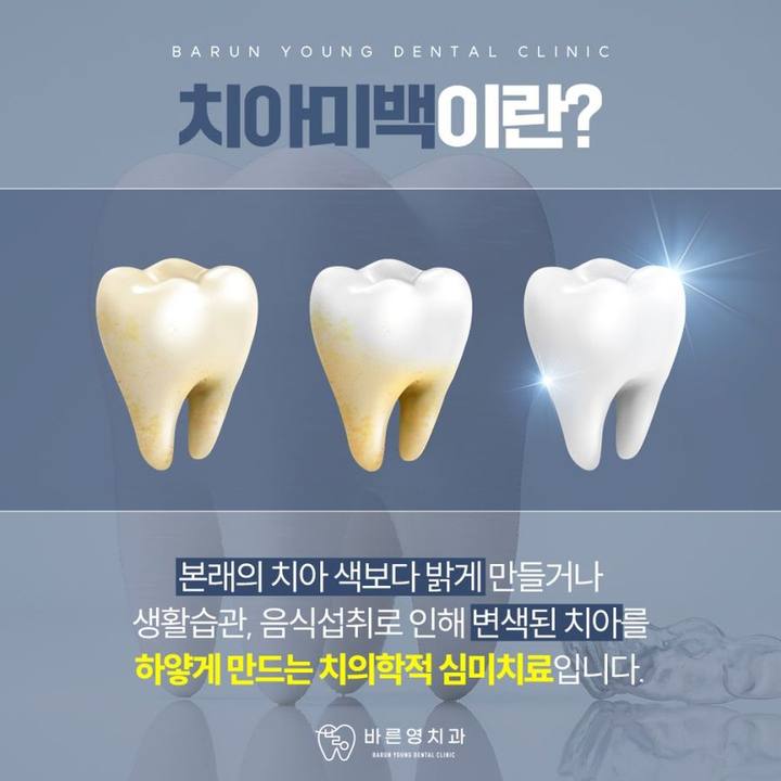 금호동치과 자연스러운 치아미백 치료를 돕는 바른영치과 사진 1