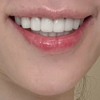 ¾Æ¸§´Ù¿î ¹Ì¼Ò1