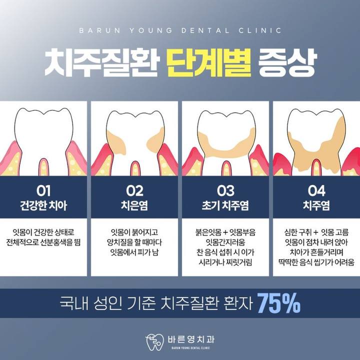 금호동치과 자주 나는 잇몸 피 치주질환 치료로 사진 9