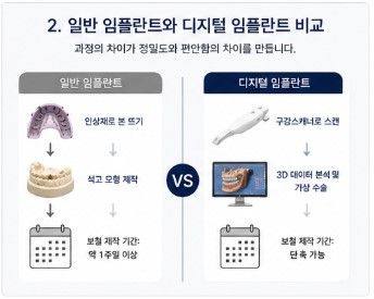 약수역치과 디지털 장비를 이용한 효율적인 임플란트 수술 및 장점 사진 4