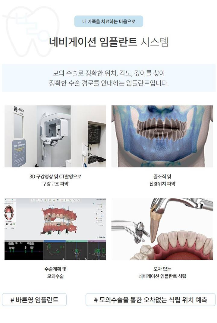 신당역치과 잃어버린 치아 네비게이션 임플란트로 되찾으세요 사진 6