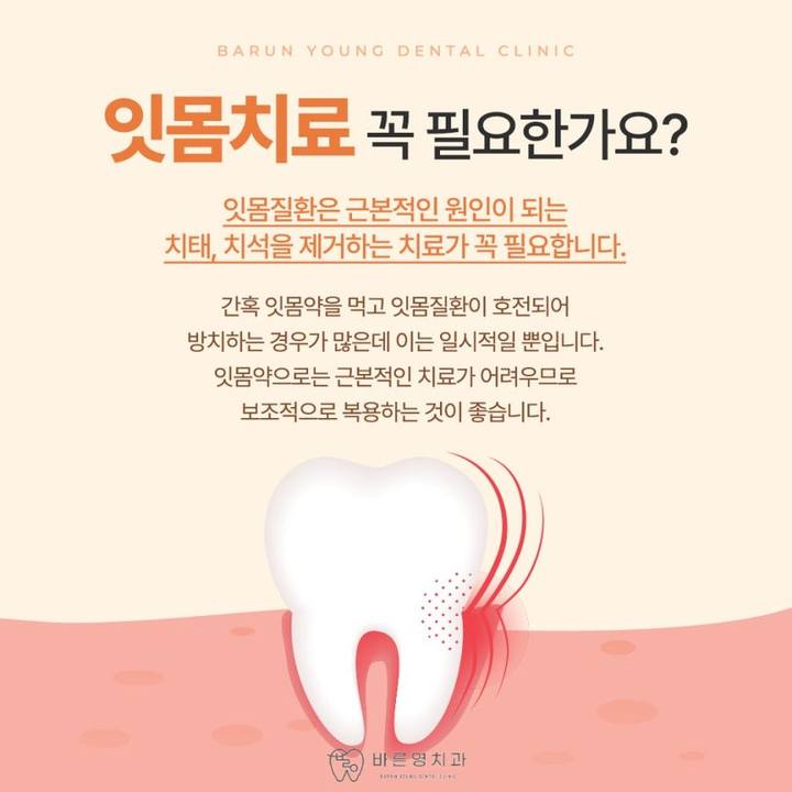 충무로치과 스케일링, 자꾸 피나고 찌릿하는 잇몸통증 이유는 치주질환? 사진 6