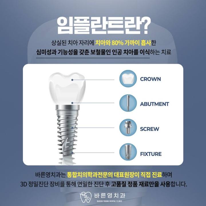 금호동치과 잃어버린치아 통증 줄인 네비게이션 임플란트로 사진 7