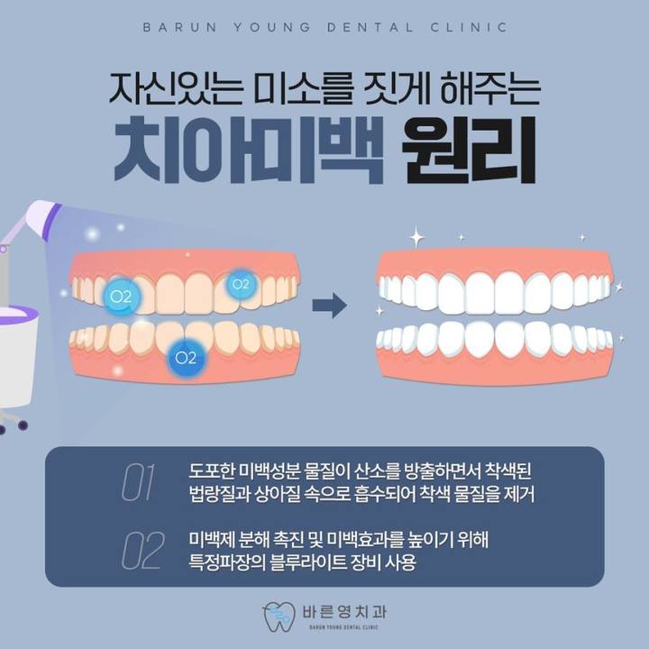 금호동치과, 누렁니 전문가 치아미백 프로그램으로 빠르고 효율적으로 사진 3