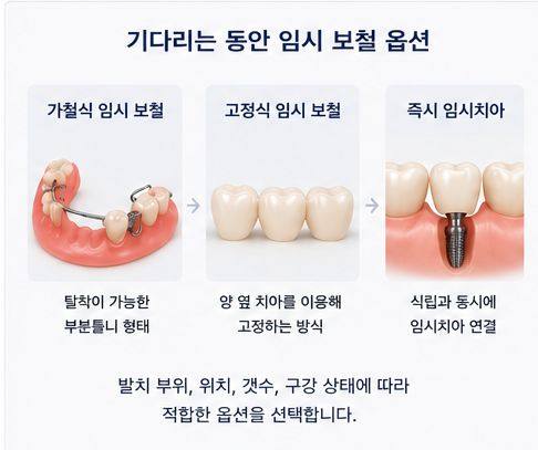 약수역 치과 발치후 임플란트 식립시기는 어떻게 정해질까요? 사진 5