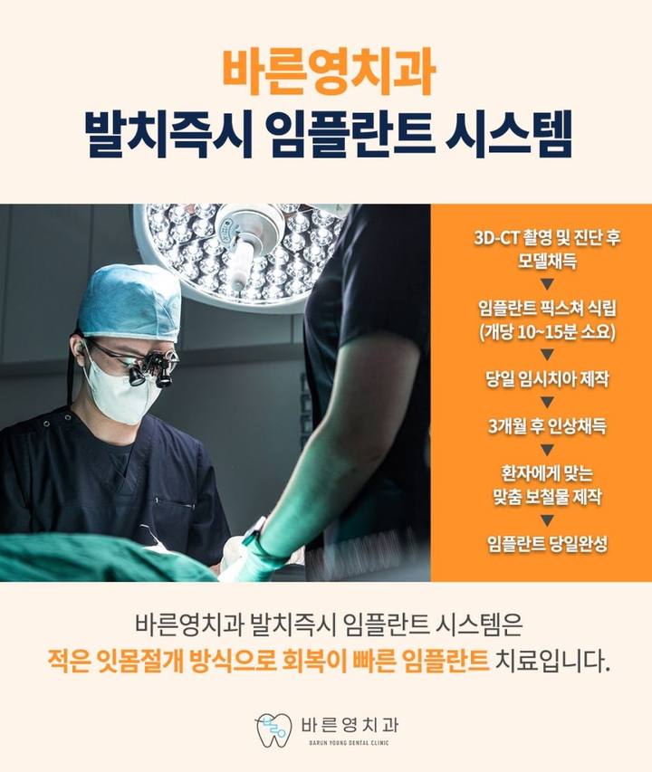 금호역치과, 환자 개개인에게 맞는 임플란트 치료의 중요성 사진 15