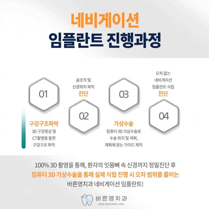 신금호역치과, 경로를 미리 파악하고 진행하는 네비게이션임플란트 사진 9