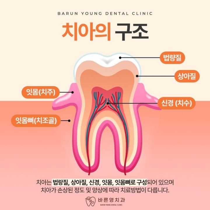 금호역치과, 통합치의학과 전문의가 1:1로 하는 충치신경치료 사진 4