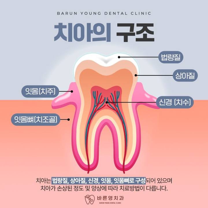 신당동치과 임플란트 비용만 보고 결정하지 말고 사진 5