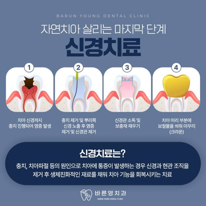 신당동치과, 자연치아 오래 사용하려면 적기에 충치치료 신경치료 사진 7