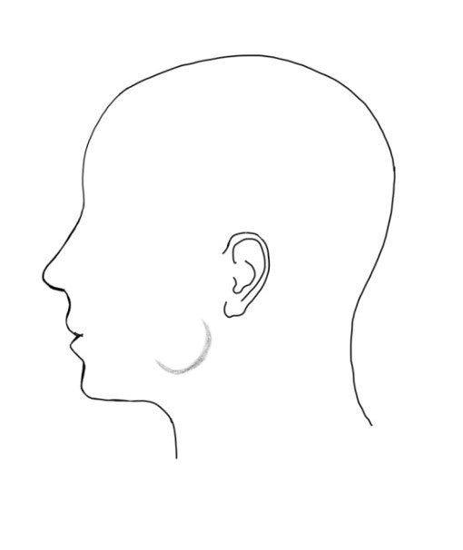 신당동 치과, 턱 보톡스 주사 이후에 나타날 수 있는 증상 ( 사각턱, 저작근, 볼 알사탕 현상) 사진 3