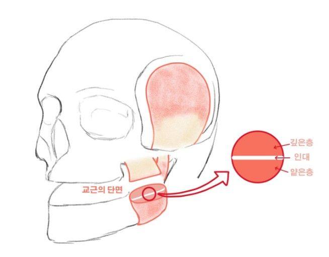 신당동 치과, 턱 보톡스 주사 이후에 나타날 수 있는 증상 ( 사각턱, 저작근, 볼 알사탕 현상) 사진 4