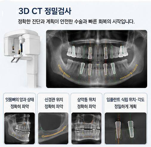 약수역 전체임플란트, 임플란트 수술은 얼마나 아플까요? 사진 4