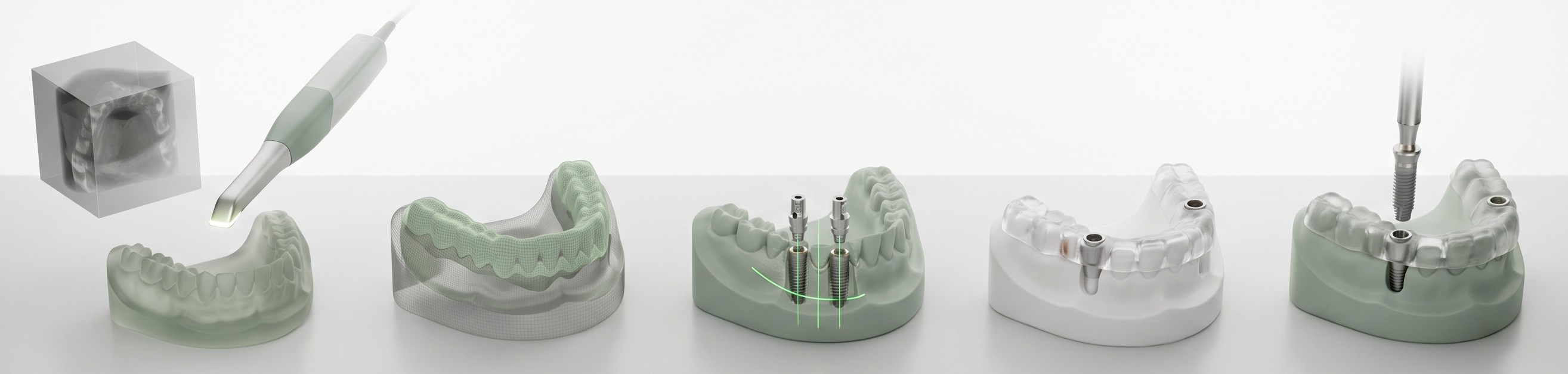 3D CT·구강스캔, 데이터 결합, 가상 식립, 가이드 제작, 계획 위치에 식립으로 이어지는 디지털 가이드 임플란트 과정 그래픽