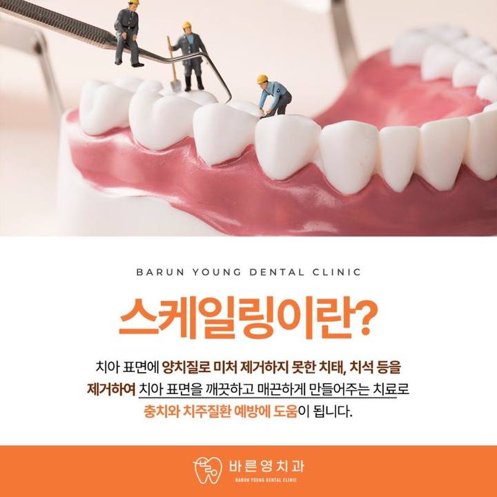 약수역치과, 치아 상실할 수도 있는 잇몸질환 예방하려면 사진 12