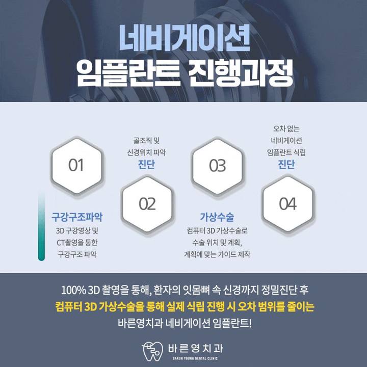 신당동치과, 적은 잇몸절개로 통증 줄여 어르신들도 가능한 임플란트 사진 7