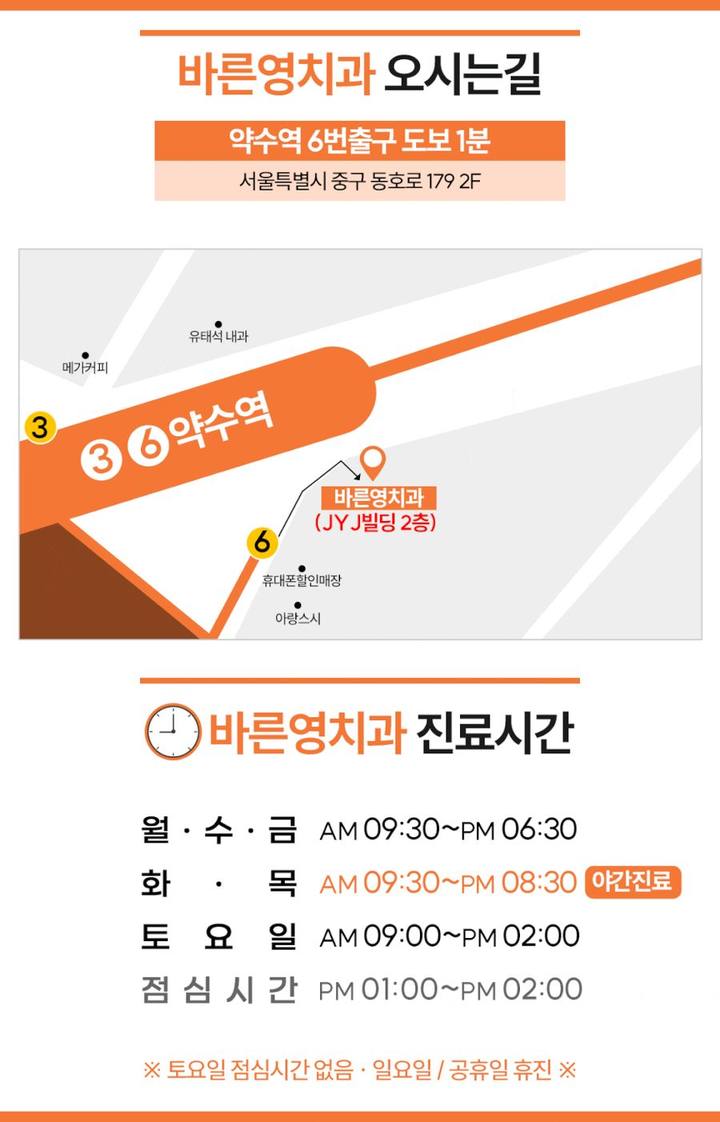 금남시장치과 미리 확인한 길 따라 진행해 안정적인 임플란트 사진 19