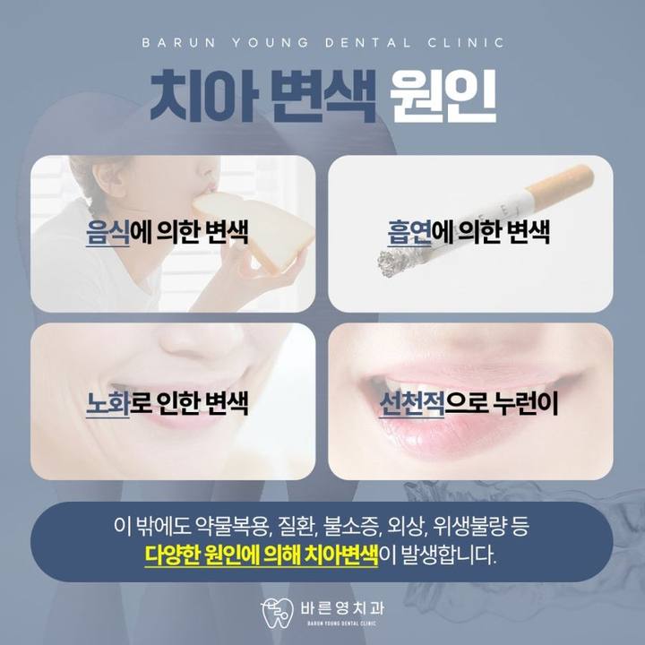 금호동치과, 누렁니 전문가 치아미백 프로그램으로 빠르고 효율적으로 사진 2