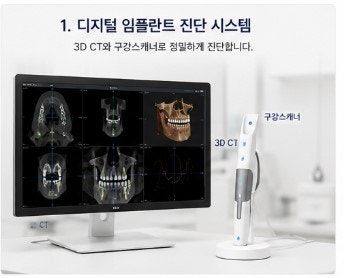 약수역치과 디지털 장비를 이용한 효율적인 임플란트 수술 및 장점 사진 1