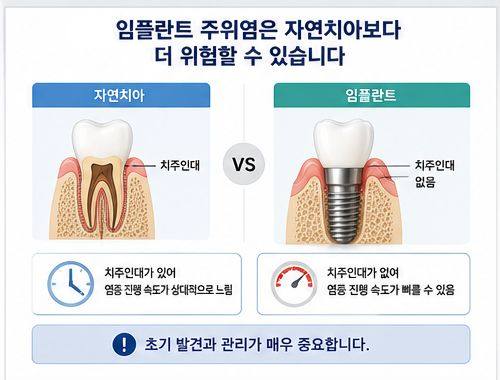 약수역 치과, 임플란트도 잇몸병이 생길 수 있을까요? 사진 3