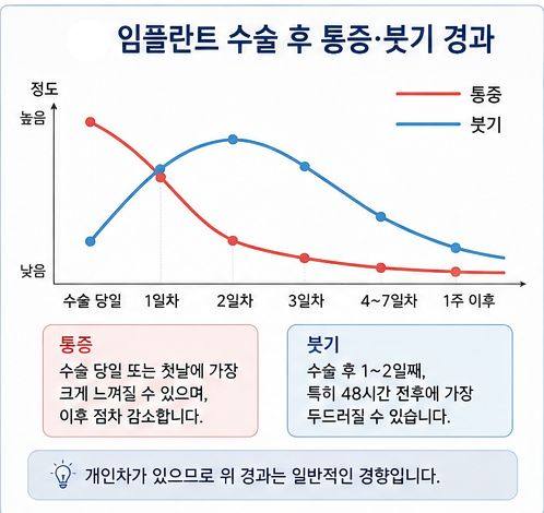 약수역 전체임플란트, 임플란트 수술은 얼마나 아플까요? 사진 1