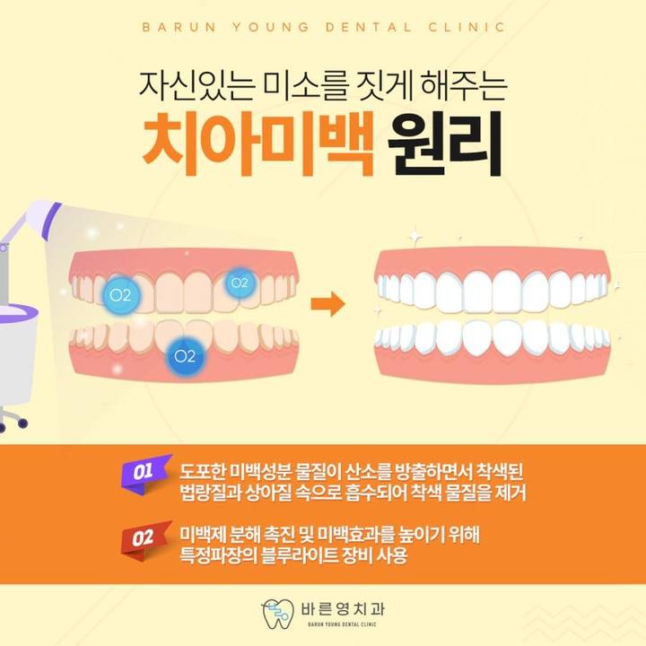 신당역치과 치아미백, 구강건강까지 지킬 수 있어야 사진 6
