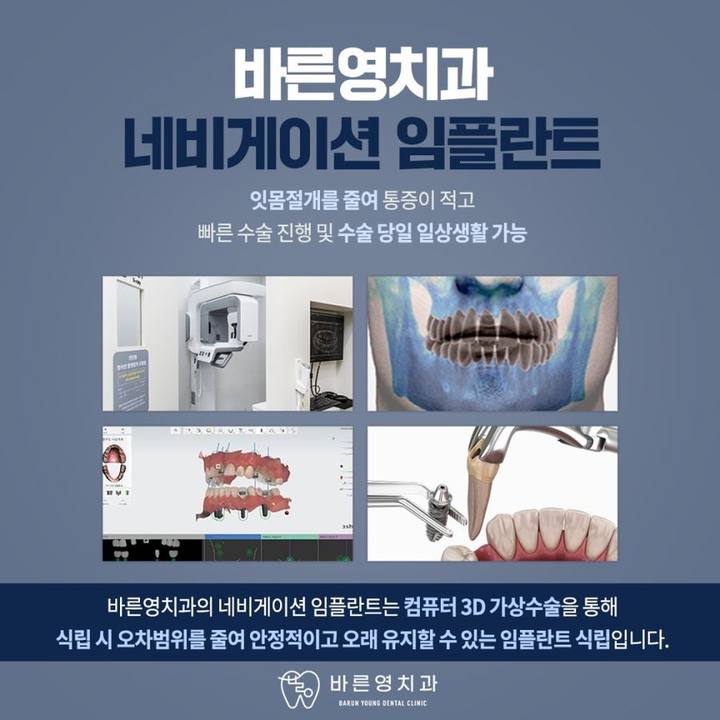 신당동치과 임플란트 비용만 보고 결정하지 말고 사진 8