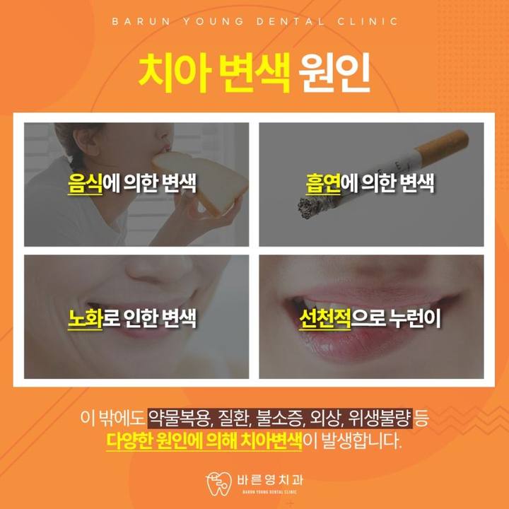 약수역치과, 1:1 맞춤 치아미백으로 자연스럽게 사진 4