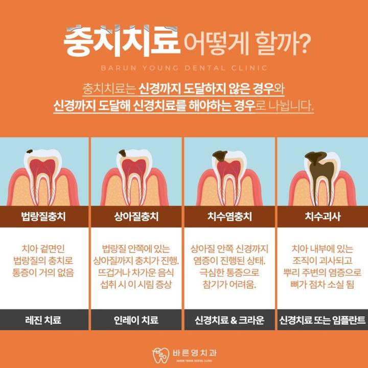 신당동치과추천 충치, 신경치료가 걱정이라면 사진 4