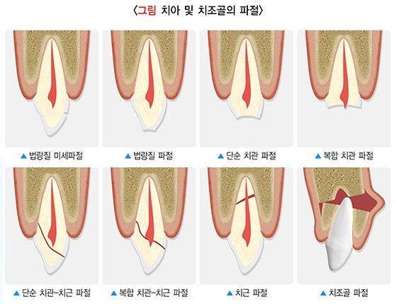 출처 : 국가건강정보포털