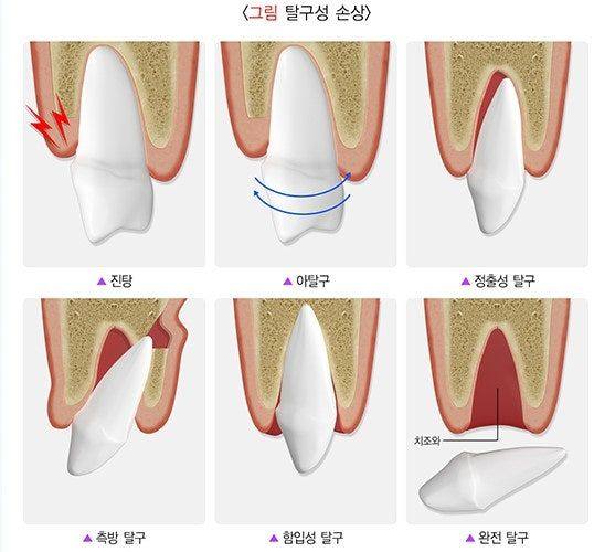 출처 : 국가건강정보포털