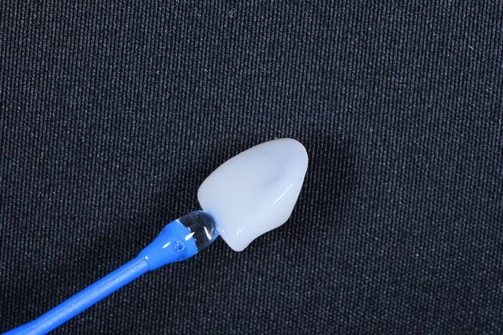 동대문 무삭제라미네이트 과거 교정한 치아가 웃을 때 안 보여 스트레스일 때 사진 6