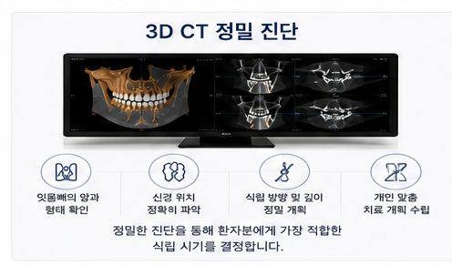 약수역 치과 발치후 임플란트 식립시기는 어떻게 정해질까요? 사진 7